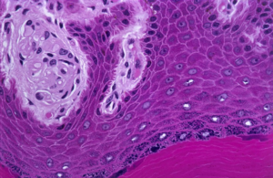 Células epiteliais de descamação